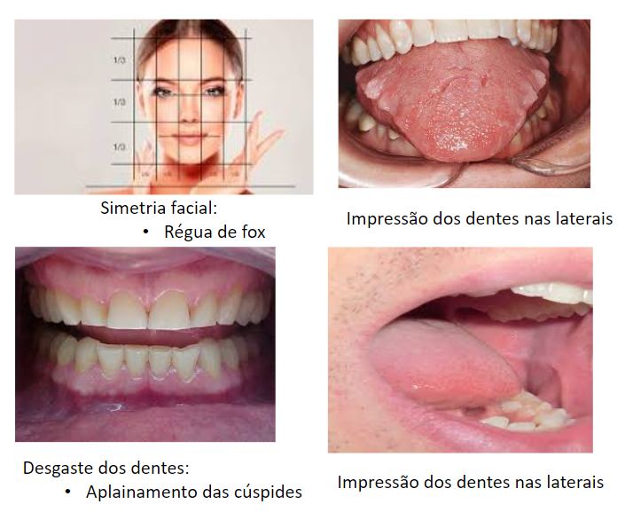 Figura 11. Avaliação dos hábitos parafuncionais. Fonte: Imagens retiradas do Google.