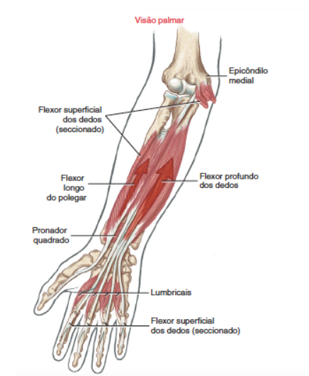 Epicondiloalgia Medial 5