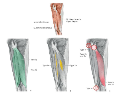Lesões Musculares