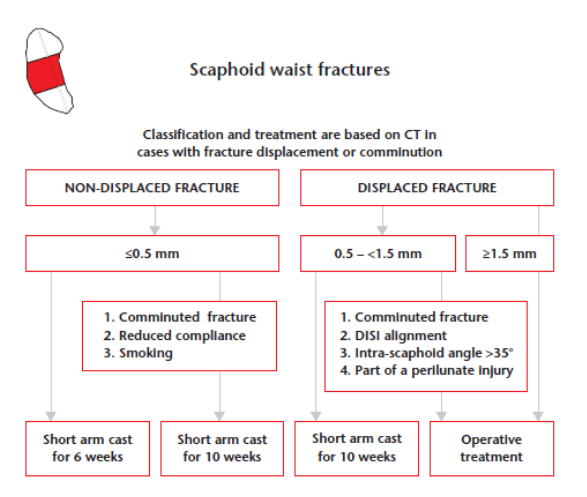Figura 19: Algoritmo fraturas de escafoide Fonte:Martin Clementson; Anders Björkman; Niels O. B. Thomsen. Acute scaphoid fractures: guidelines for diagnosis and treatment. EFORT Open Rev 2020;5:96-103. DOI: 10.1302/2058-5241.5.190025.