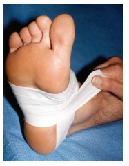 Figura 26: Bandagem rígida Low-Dye. Fonte: Landorf et al., 2005.