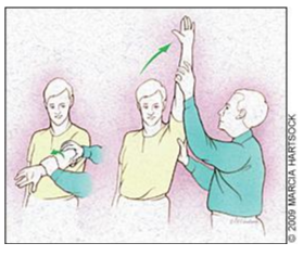 Figura 4. Neers test. Fonte: Churgay CA. Diagnosis and treatment of biceps tendinitis and tendinosis. Am Fam Physician. 2009 Sep 1;80(5):470-6. PMID: 19725488.