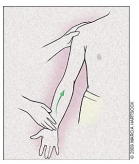 Figura 5. Speed test. Fonte: Churgay CA. Diagnosis and treatment of biceps tendinitis and tendinosis. Am Fam Physician. 2009 Sep 1;80(5):470-6. PMID: 19725488.