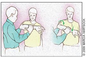 Figura 6. Hawkins test. Fonte: Churgay CA. Diagnosis and treatment of biceps tendinitis and tendinosis. Am Fam Physician. 2009 Sep 1;80(5):470-6. PMID: 19725488.