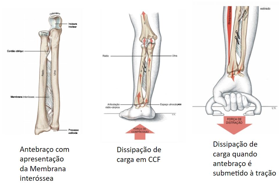 Figura 7: NÃO se deve utilizar apoio na região da fossa poplítea.