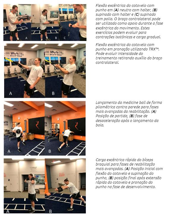 Figura 7. Exemplo de progressão de exercícios para fortalecimento gradual do bíceps braquial. Fonte: Holshouser C, Jayaseelan DJ. Multifaceted Exercise Prescription in the Management of an Overhead Athlete with Suspected Distal Biceps Tendinopathy: A Case Report. Journal of Functional Morphology and Kinesiology. 2020; 5(3):56. https://doi.org/10.3390/jfmk5030056.