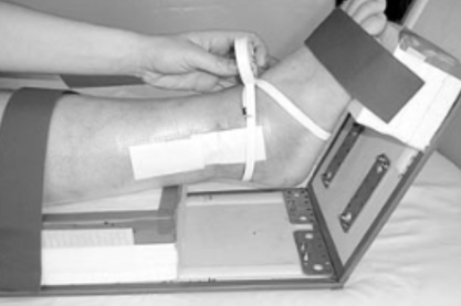 Figura 7: Demonstração da medida de Figura em 8 para edema do tornozelo. Fonte:Rohner-Spengler M et al, Reliability and Minimal Detectable Change for the Figure-of-Eight-20 Method of Measurement of Ankle Edema, J Orthop Sports Phys Ther, 2007 Apr;37(4):199-205.