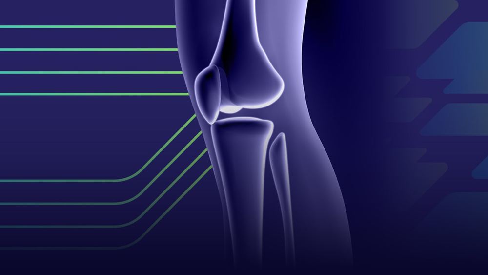 Fraturas de Platô Tibial