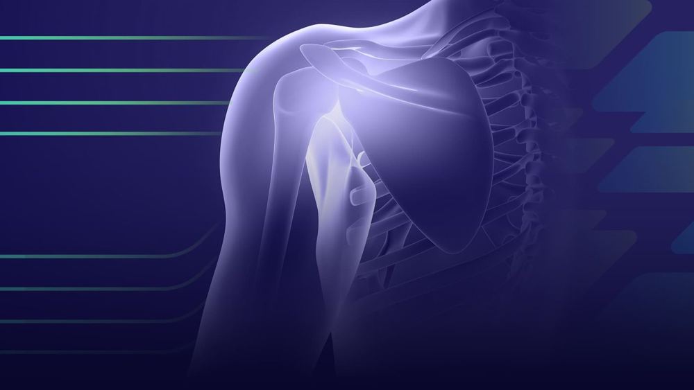 Osteoartrite de Joelho