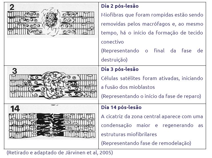 Lesões Musculares