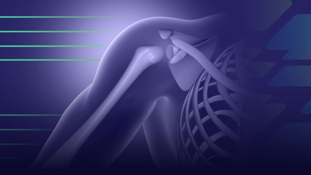 Epicondiloalgia Lateral