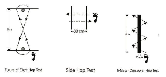 Figura 15: Hop Tests - Testes funcionais em diferentes direções. Leva-se em consideração o tempo que o paciente executa o teste escolhido, e compara-se o mesmo teste após algumas semanas de tratamento. Fonte: Caffrey E et al. The ability of 4 single-limb hopping tests to detect functional performance deficits in individuals with functional ankle instability. J Orthop Sports Phys Ther. 2009 Nov;39(11):799-806.