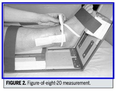 Figura 8: Demonstração da medida de Figura em 8 para edema do tornozelo. Fonte: Rohner-Spengler M et al, Reliability and Minimal Detectable Change for the Figure-of-Eight-20 Method of Measurement of Ankle Edema, J Orthop Sports Phys Ther, 2007 Apr;37(4):199-205.